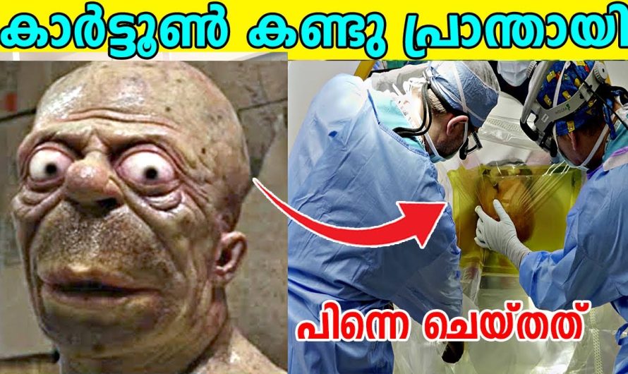 കാർട്ടൂൺ കഥാപാത്രം ആകാൻ സർജറി ചെയ്തു | യഥാർത്ഥ ജീവിതത്തിലെ കാർട്ടൂൺ കഥാപാത്രങ്ങൾ