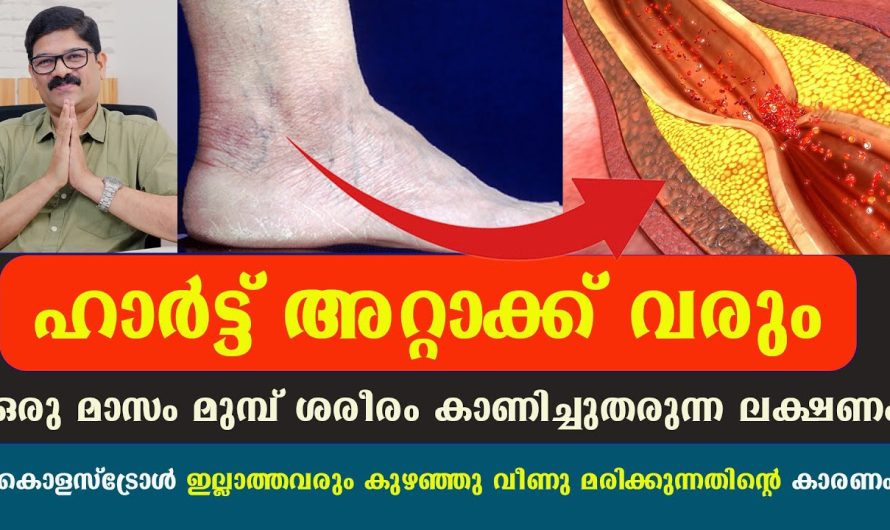 ഹാർട്ട് അറ്റാക്ക് വരും ഒരു മാസം മുമ്പ് ശരീരം കാണിച്ചുതരുന്ന ലക്ഷണം പരിഹാരം