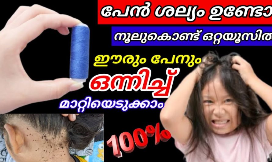 💯 നൂല് മാത്രം മതി തലയിലെ പേനും ഈരും ഒറ്റ ദിവസം കൊണ്ട് കളയാം