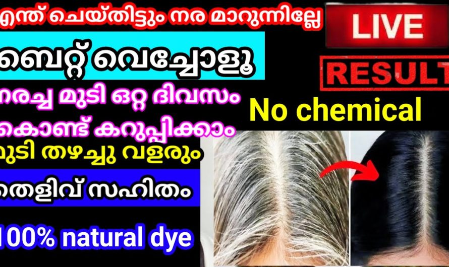 നരച്ച മുടി ഒറ്റ യൂസിൽ കട്ട കറുപ്പ്‌ ആവും ബെറ്റ് വെച്ചോളൂ ലൈവ് ആയി റിസൾട്ട്‌ കാണാം