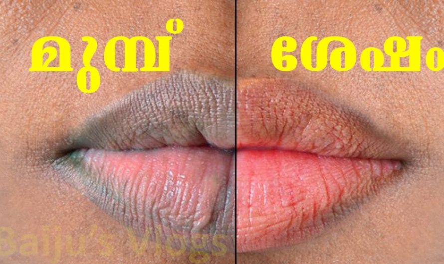 കറപിടിച്ചു കറുത്തിരുണ്ട ചുണ്ടുകള്‍ തൊണ്ടിപ്പഴം പോലെ ചുവക്കാന്‍