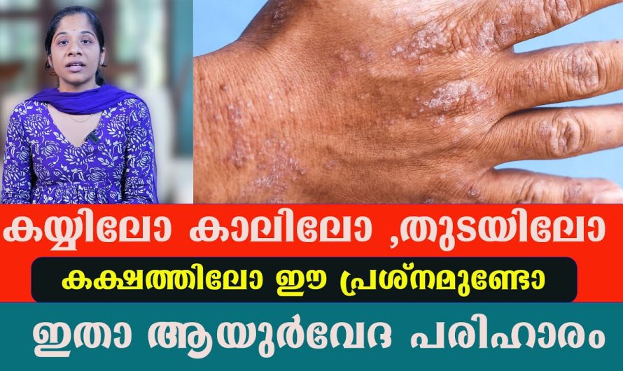 കയ്യിലോ കാലിലോ ,തു.ടയിലോ കക്ഷത്തിലോ ഈ പ്രശ്നമുണ്ടോ ഇതാ ആയുർവേദ പരിഹാരം