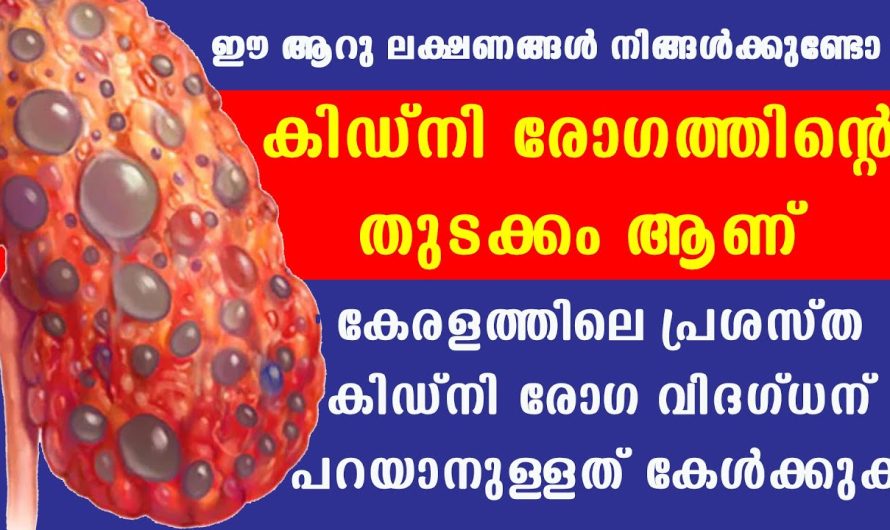 ഈ ആറ് ലക്ഷണങ്ങൾ നിങ്ങൾക്കുണ്ടോ നിങ്ങളുടെ കി.ഡ്‌.നി. നശിച്ചുതുടങ്ങി